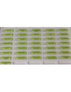 Test enfermedades higado y vesícula biliar 2